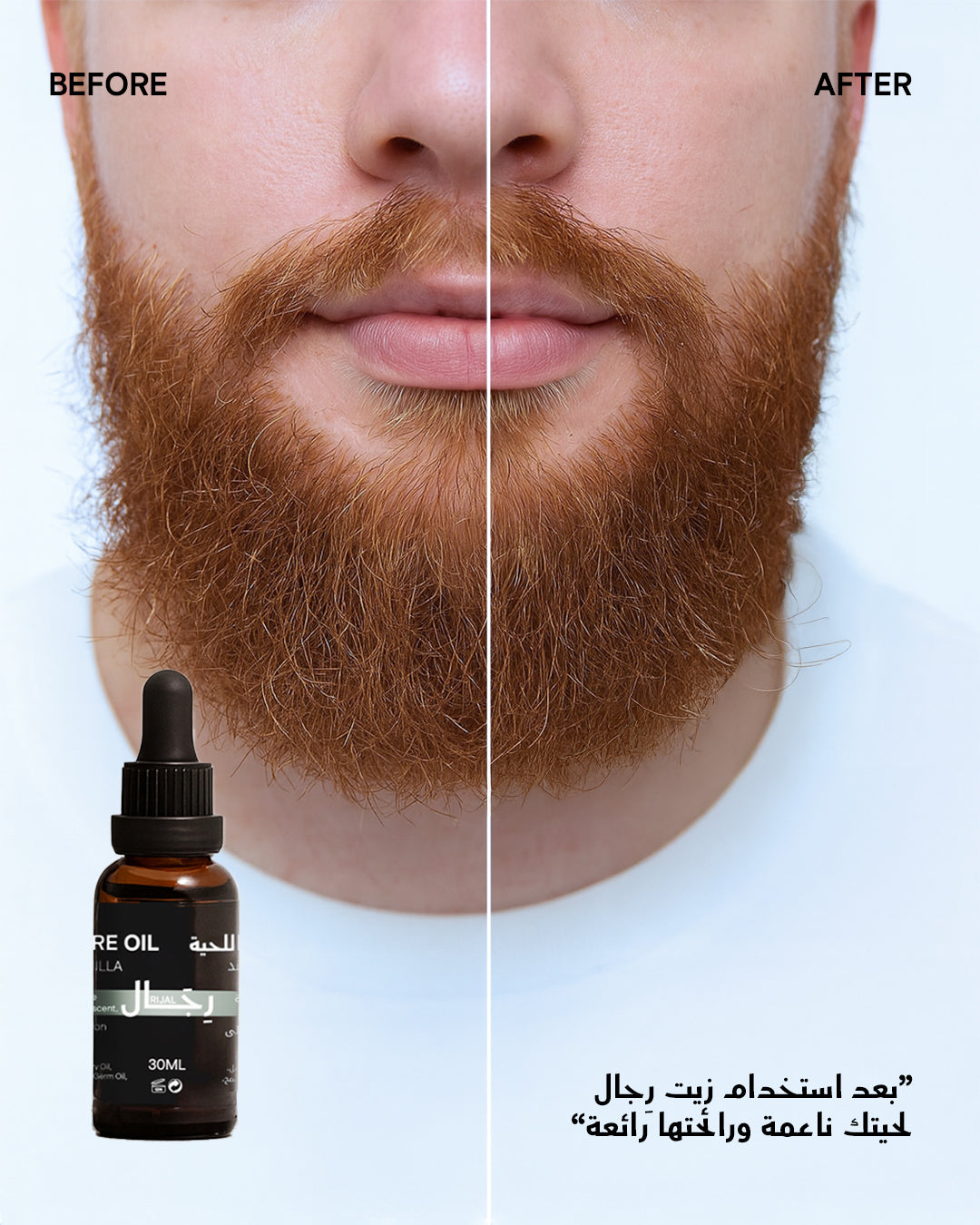 Beard Oil - زيت اللحية